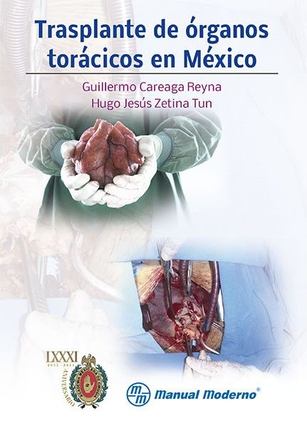 Trasplante de órganos torácicos en México