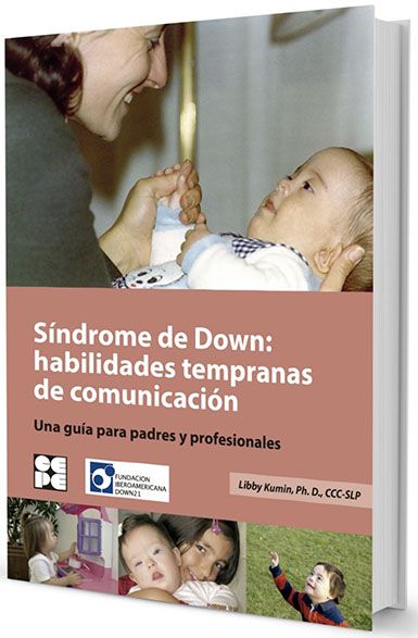 Síndrome de Down: Habilidades tempranas de comunicación. 